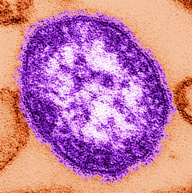 This undated image made available by the Centers for Disease Control and Prevention on Feb. 4, 2015 shows an electron microscope image of a measles virus particle, center. 