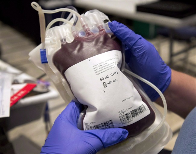 A new study suggests freshly donated blood is not better than older blood when it is transfused into severely ill patients.
