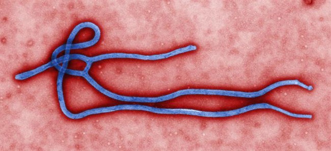 The Ebola virus under a microscope.
