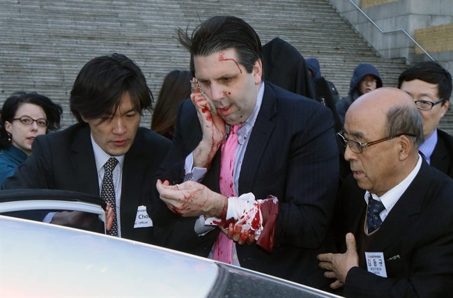 Injured U.S. Ambassador to South Korea Mark Lippert, center, gets into a car to leave for a hospital in Seoul, South Korea, Thursday, March 5, 2015, after being  attacked by a man wielding a razor.