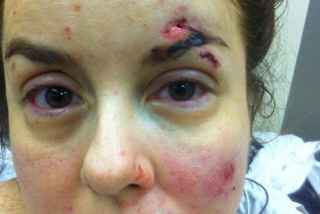 Simona Tibu shares photos of herself after the traffic stop on Aug. 3, 2013.