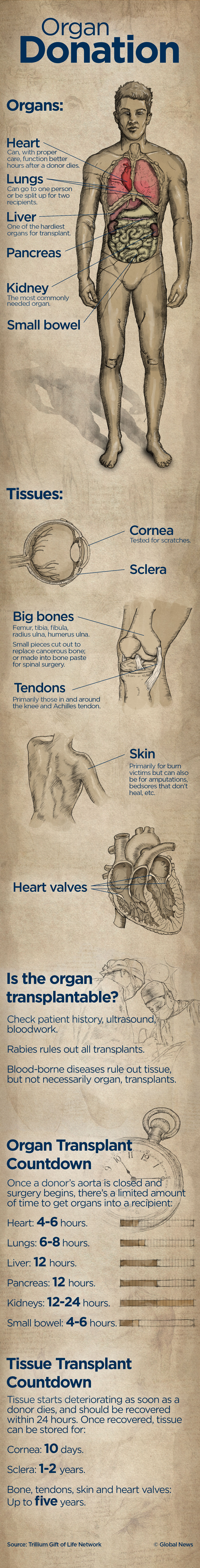 Canada’s organ donor rate lags behind other countries. How do you fix it? - image