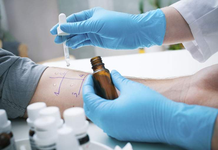 Food bans – Part 3: Allergy tests full of false positives, doctor explains - image