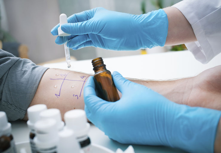 Food bans – Part 3: Allergy tests full of false positives, doctor explains - image