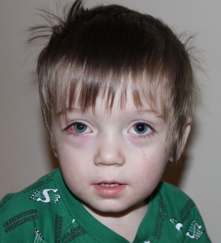 How looking over photos of your child could save their eyesight - image