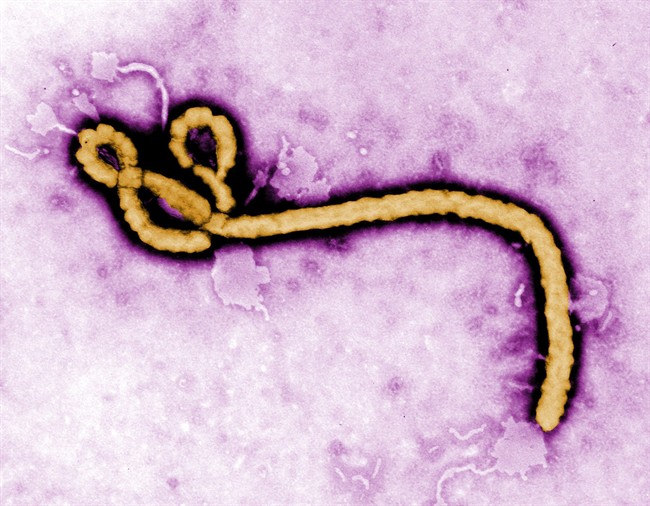 This undated colorized transmission electron micrograph image made available by the CDC shows an Ebola virus virion.
