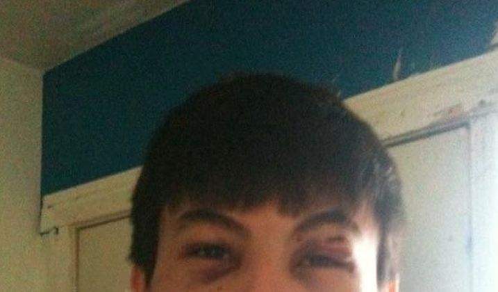 The complainant shared this photo of his injuries with Global News.