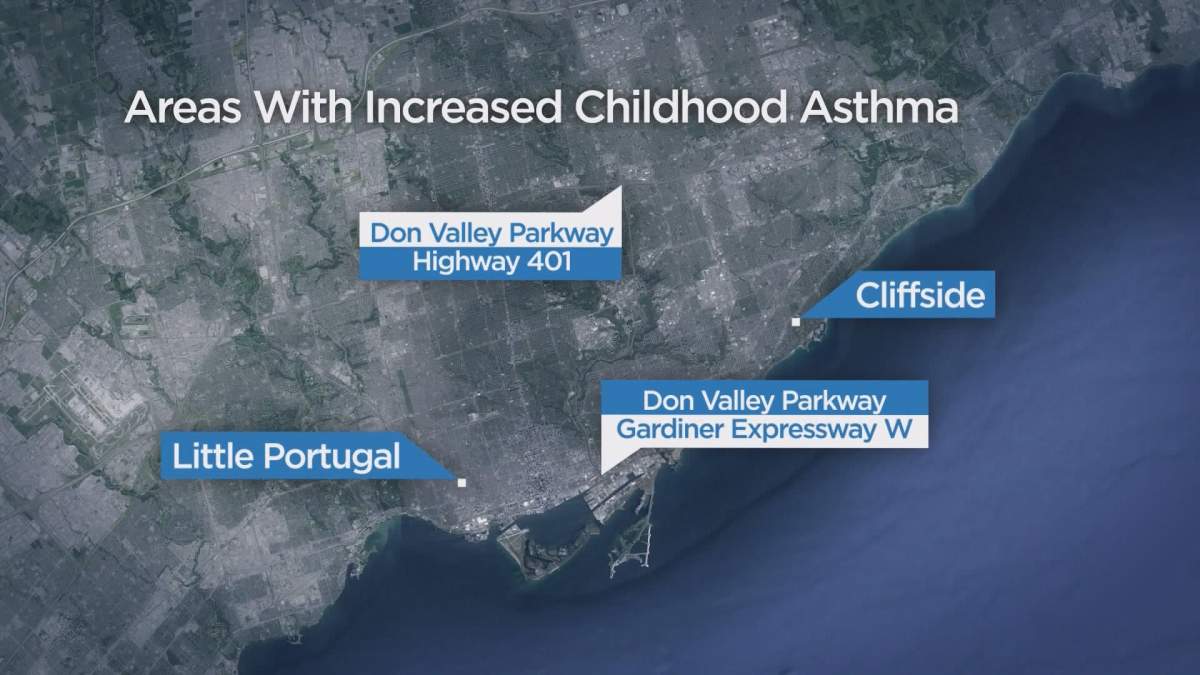 Poorer, more polluted Toronto neighbourhoods have higher childhood asthma rates: Study - image