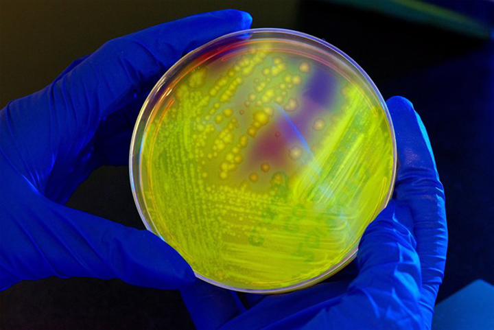 A new study looks at how high antibiotics use affects the health of nursing home residents. C. difficile bacteria in a petri dish is shown in an undated photo. 