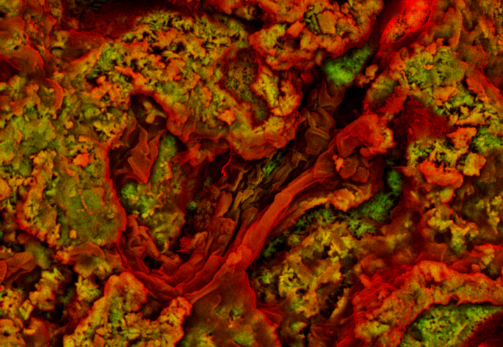 These fibre-like structures are believed to be collagen from a 75-million-year-old dinosaur.