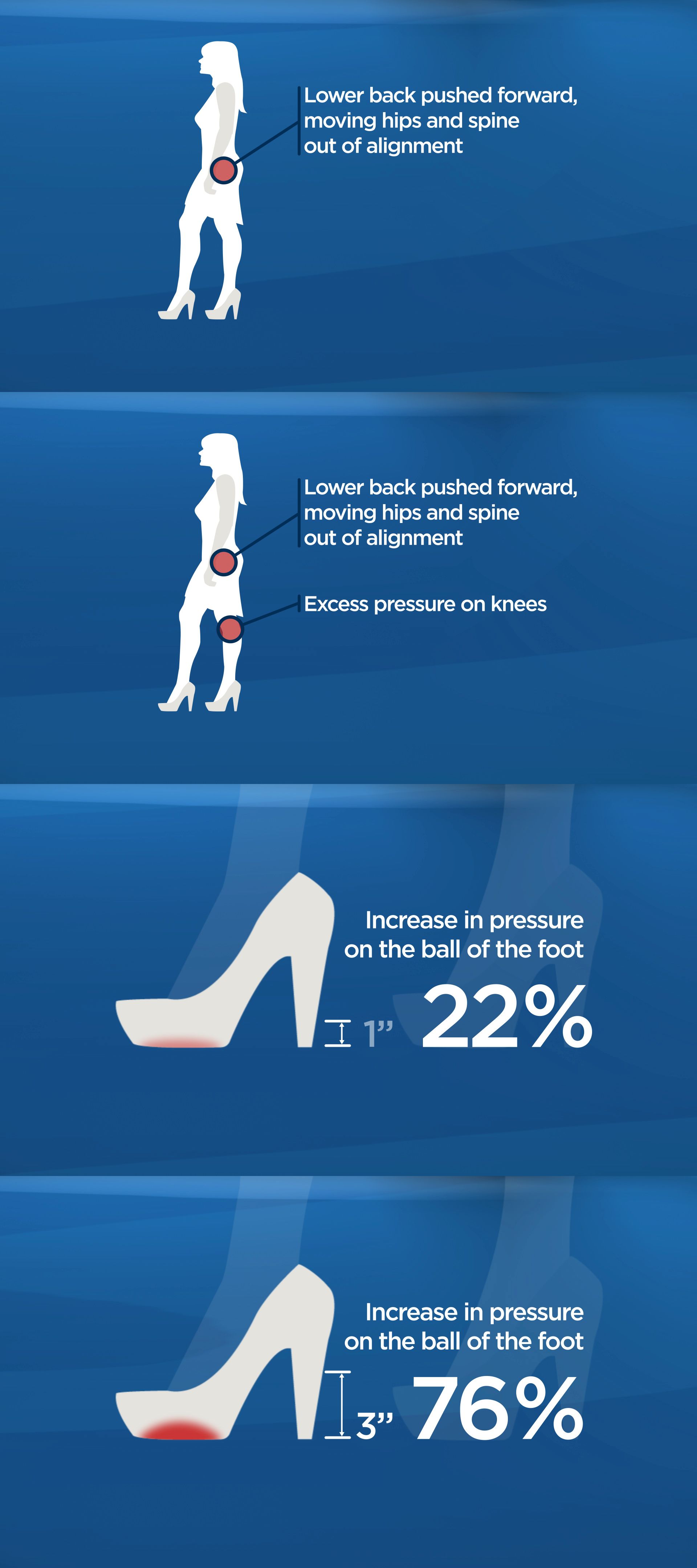 The Cost of Wearing High Heels