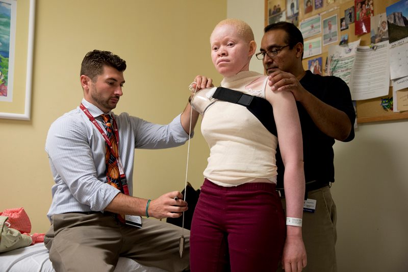 Lance Harms, left, and Luis Velasquez, fit Kabula Masanja, 17, for a prosthetic limb at the Shriners Hospital for Children in Philadelphia on Thursday, July 23, 2015.