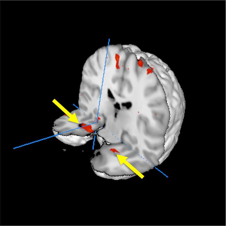 Combined brain scan image shows average across all passengers in the study.