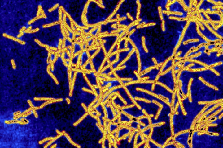 Legionnaires' Bacteria Found in NYC Museum Cooling Systems