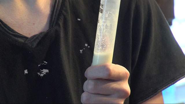 Utah man has rare disorder that makes him allergic to food - image