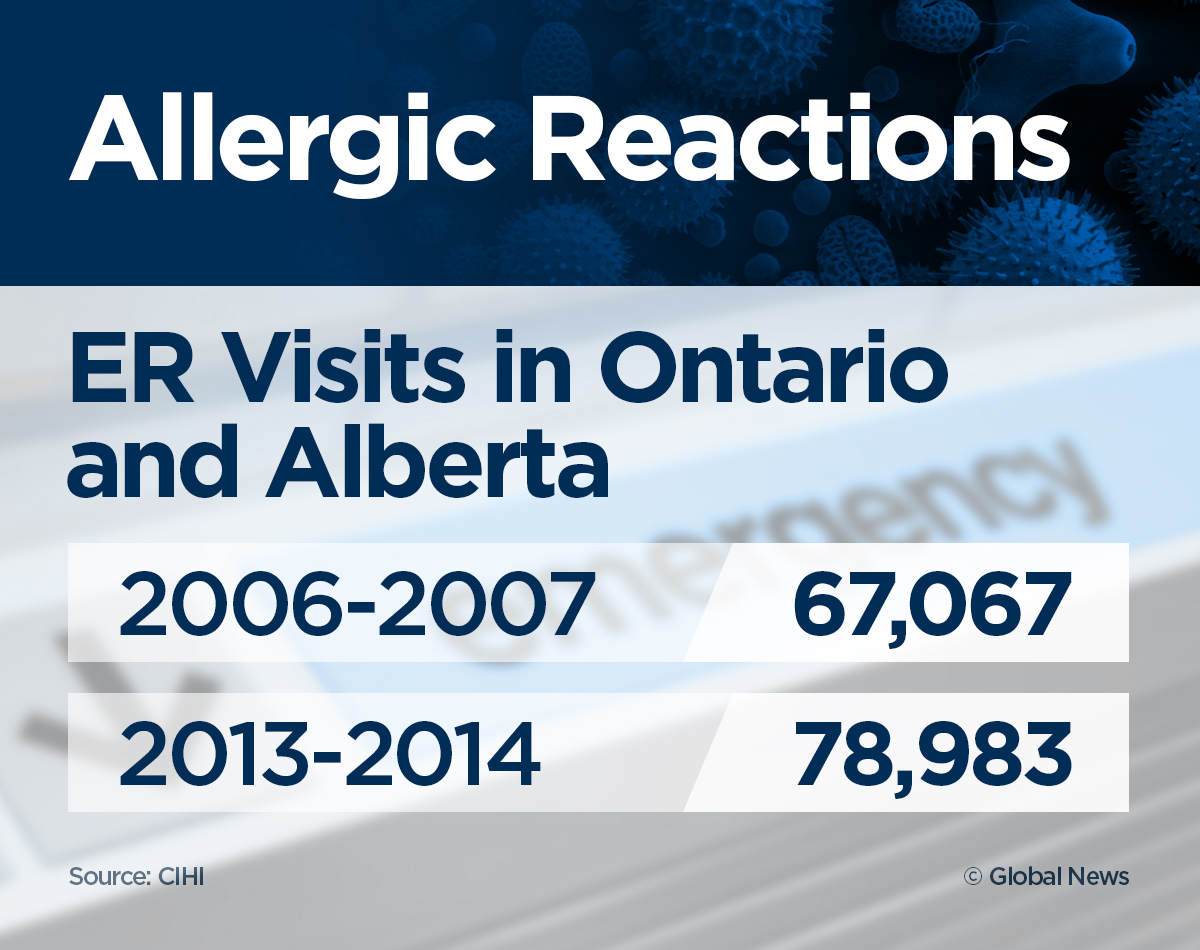 ‘It was terrifying’: ER visits for anaphylaxis up 95% in 7 years - image