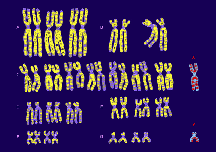 Understanding the ‘guevedoce’: Children raised as girls who develop penises at puberty - image