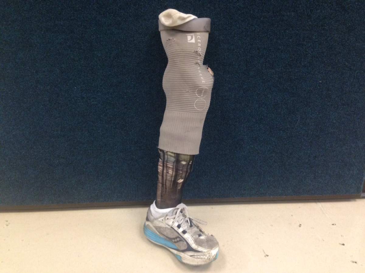 Homeless Penticton woman reunited with missing leg - image