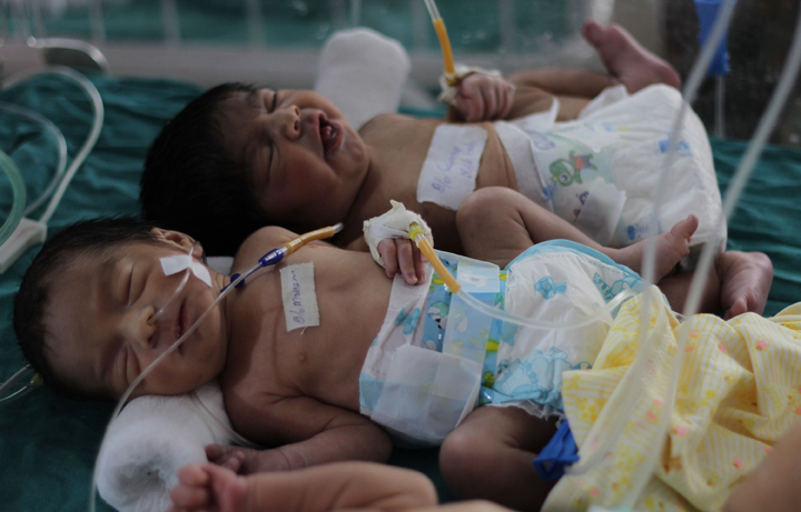 It's a girl -- or is it? A condition referred to as "guevedoce" -- where a child develops a penis at puberty -- in the Dominican Republic is being profiled in a new BBC documentary program.