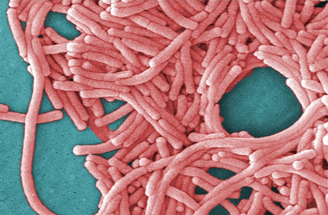 A close-up shot of Legionella pneumophila bacteria (Legionnaires' disease).