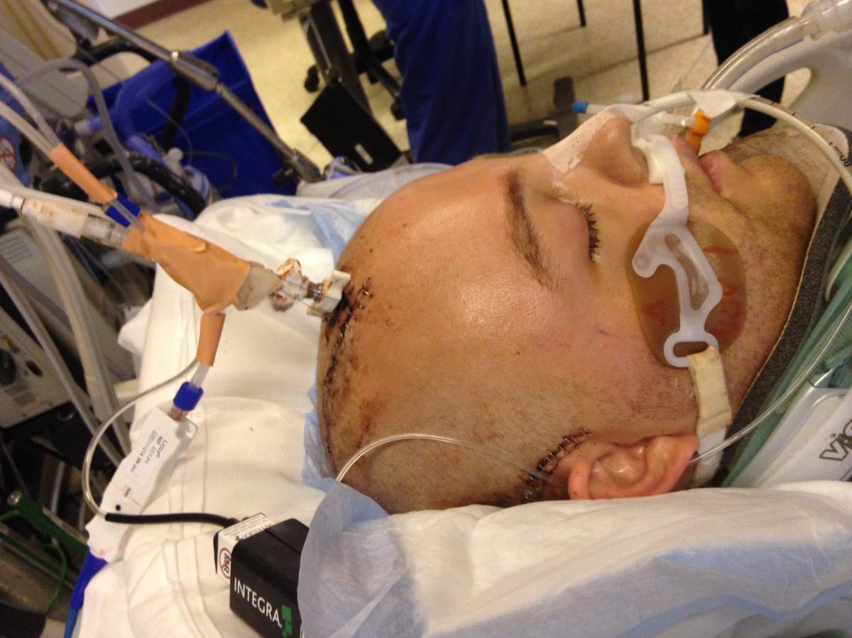Unprovoked assault leaves Vancouver man with brain damage - image