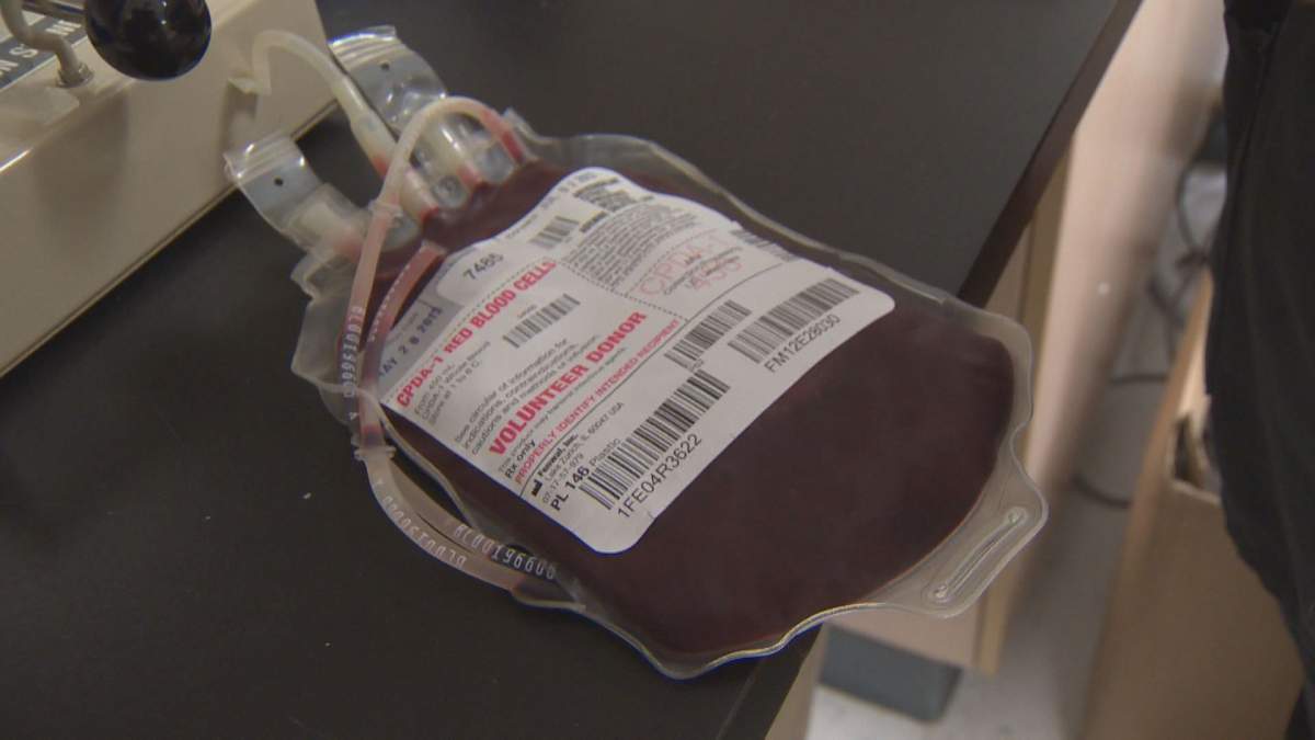 A unit of blood donated at the CABB.