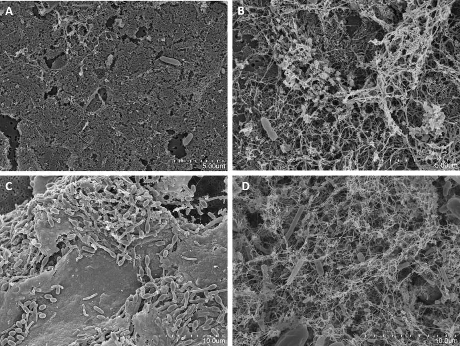 Chronological series of images of coffee machine drip tray samples taken after 4 (A), 8 (B), 14 (C), and 21 days (D) of operation. Figure C corresponds to a sample highly abundant in Bacillus spp. Scale bars are indicated in each case.