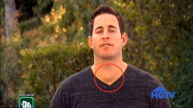 Tarek El Moussa