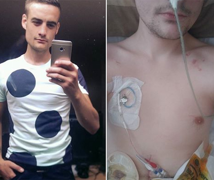 Late last month, Stephen "Ste" Walker, 24, took to Facebook and posted a powerful message about what life is like suffering from Crohn's after he was asked why he’s “conning the system.”.