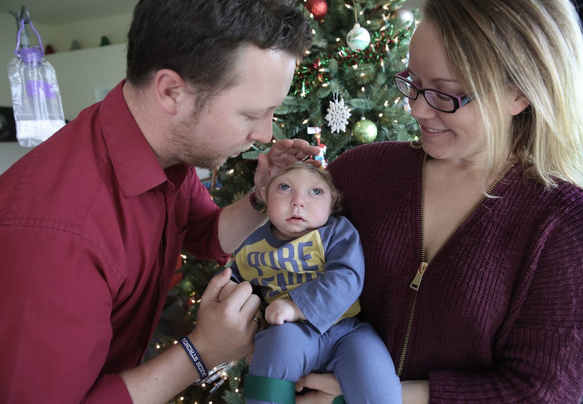In this Tuesday, Dec. 22, 2015 photo, Brandon and Brittany Buell hold their year-old son Jaxon, who was born with a rare condition that prevented much of his brain from forming and left half his skull flat, in Tavares, Fla. The couple said presents have piled up for Jaxon, whose Christmas card with Santa captivated readers nationwide. 