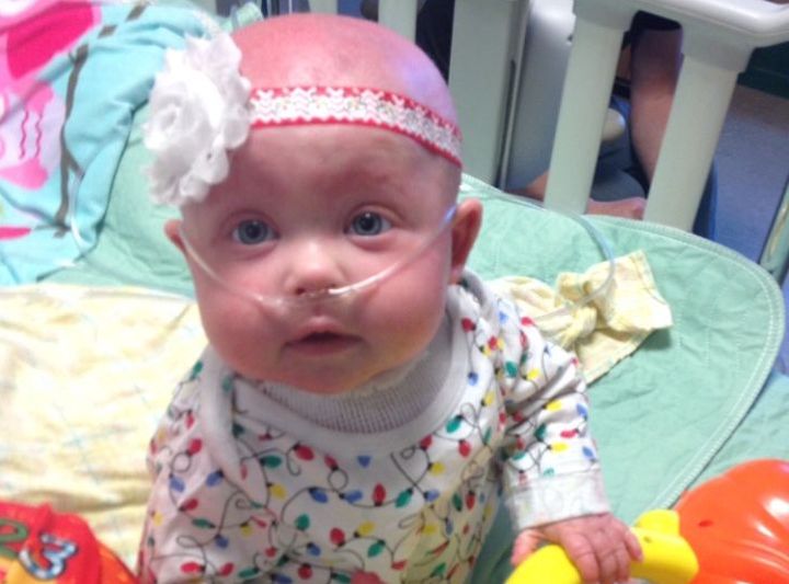 Bella Thomson spent over two years in hospital being treated for SCID.