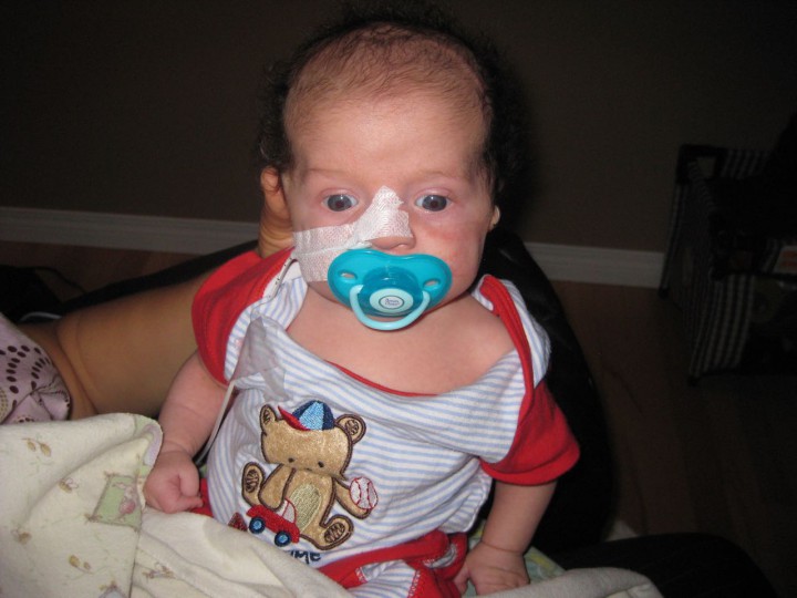 Saskatoon child denied funding to treat digestive disorder - image