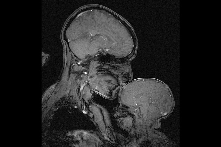 An MRI image of Rebecca Saxe with her infant son.