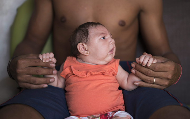 Dejailson Arruda holds his daughter Luiza at their house in Santa Cruz do Capibaribe, Pernambuco state, Brazil. Luiza was born in October with a rare condition, known as microcephaly. Luiza's mother Angelica Pereira was infected with the Zika virus after a mosquito bite. 