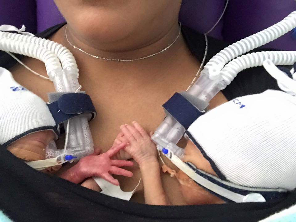 On Facebook, the twins’ mother said the babies kept holding hands.