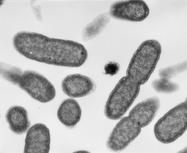 Electron micrograph images of E.coli are shown in a handout photo.