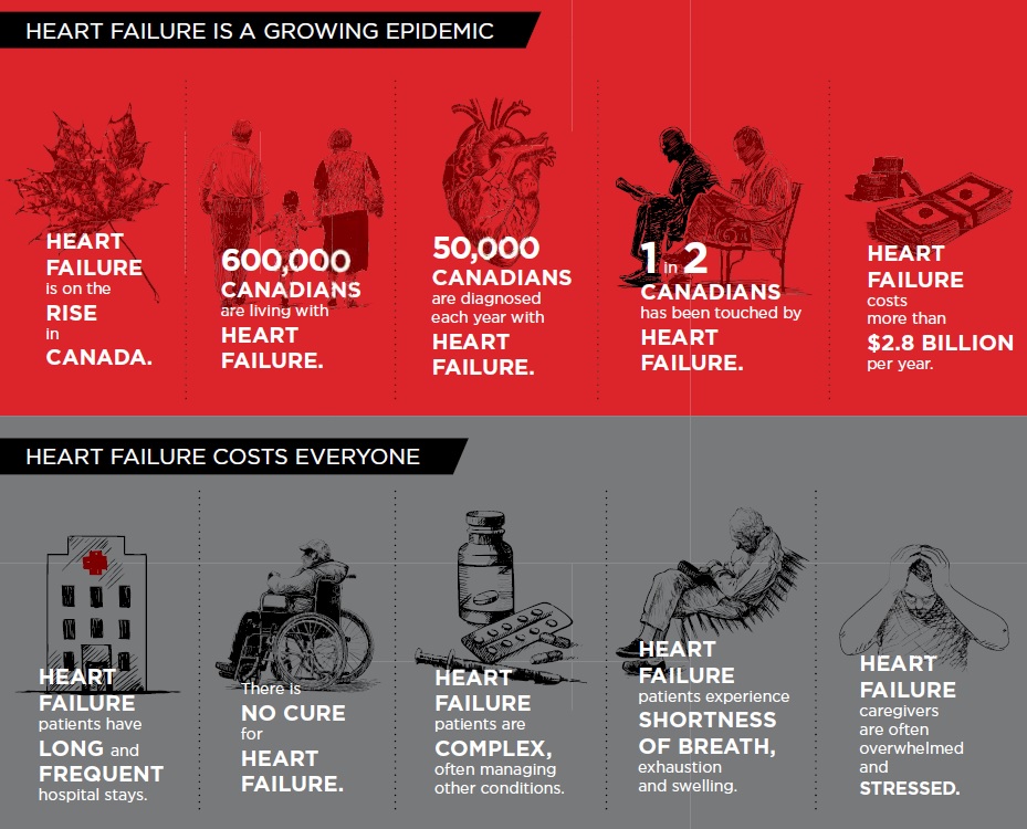 In recent years, bypass surgery has increasingly been recommended for such heart failure patients, along with medicines to ease heart failure symptoms.(Courtesy Heart and Stroke Foundation).