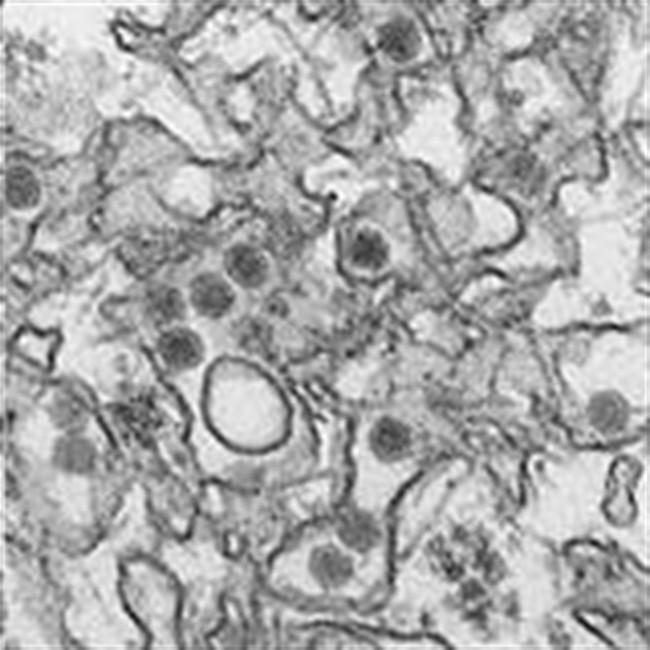 This January 2016 microscope image provided by the Centers for Disease Control and Prevention shows the Zika virus. On Tuesday, Feb. 23, 2016, the CDC said it is investigating more than a dozen possible Zika infections that may have been spread through sex. The 14 cases all involve men who visited areas with Zika outbreaks, and who many have infected their female sex partners, who had not traveled. 