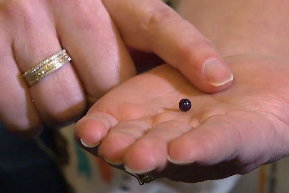 In this undated image taken from video provided by KOMOnews.com, Lindsay Hasz holds a rare pearl that she found in her seafood meal while dining at an Italian restaurant in Issaquah, Wash. 