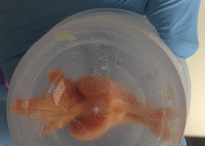 The brain of a rabbit which was successfully preserved through cryogenics.