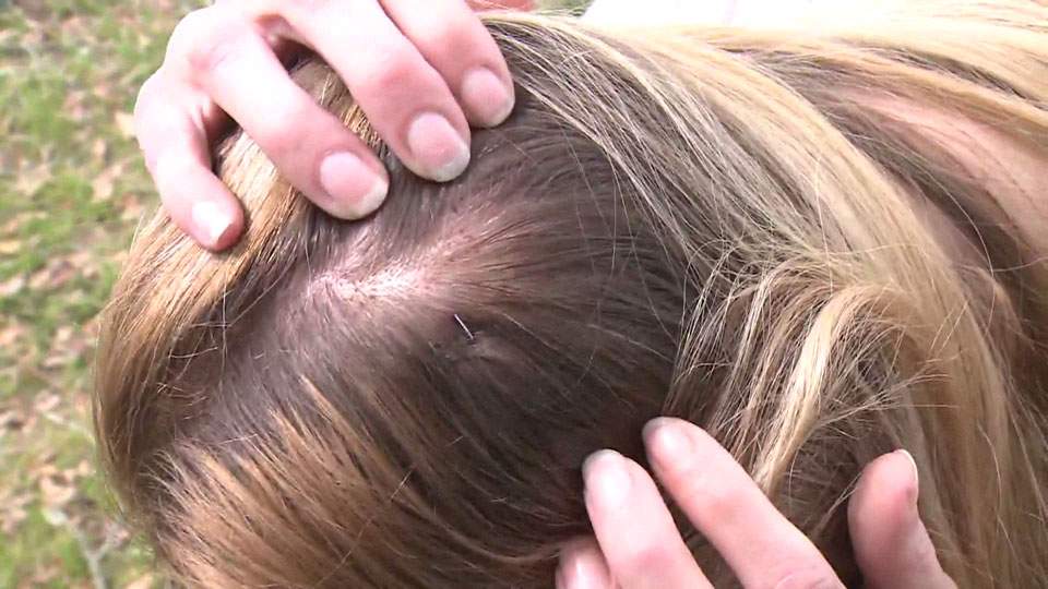 Caught on camera: police injures shoplifter during arrest, suspect claims excessive force unnecessary - image