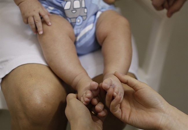 A health worker gives foot massage to 3-month-old Pedro Henrique in a hospital in Joao Pessoa, Brazil, Wednesday, Feb. 24, 2016, during an examination that's part of a study to determine if the Zika virus is causing babies to be born with a birth defect affecting the brain.