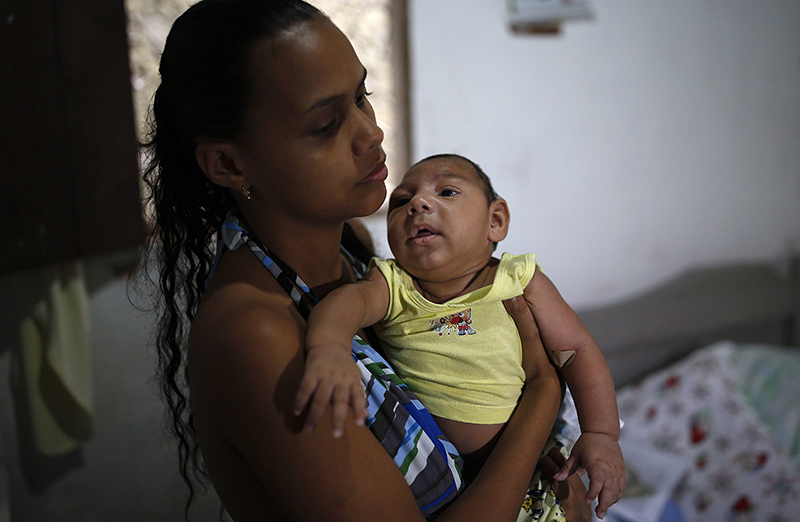 Janine Santos holds her 3-month-old son Shayde Henrique who was born with microcephaly while health workers visit her home in Joao Pessoa, Brazil, Tuesday, Feb. 23, 2016. 