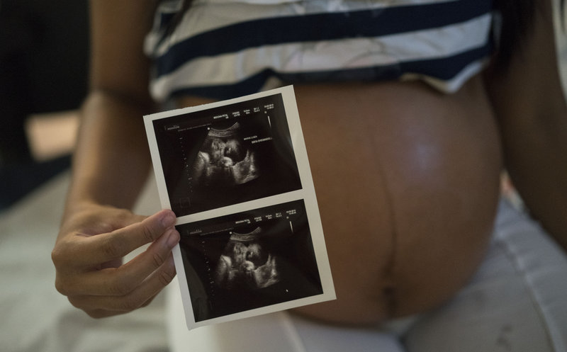 A woman who is six months pregnant shows a photo of her ultrasound at the IMIP hospital in Recife, Pernambuco state, Brazil, on Wednesday. Scientists are trying to figure out how Zika virus may be affecting fetuses.