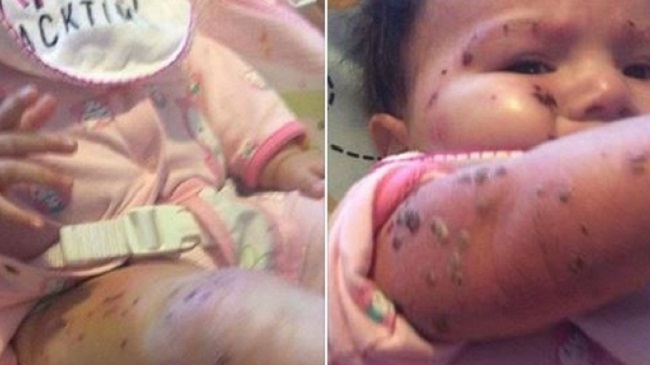 A photo of a child suffering from a skin condition posted to the Facebook group Help the Children of Kashechewan.