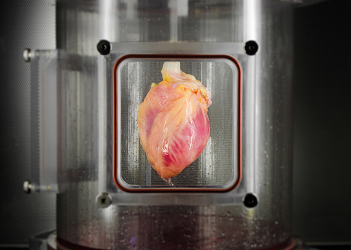 A partially recellularized human whole-heart scaffold being cultured in a nutrient solution. 