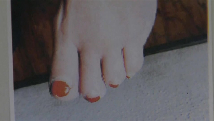 . woman sues nail shop after pedicure infection leads to loss of toe -  National 