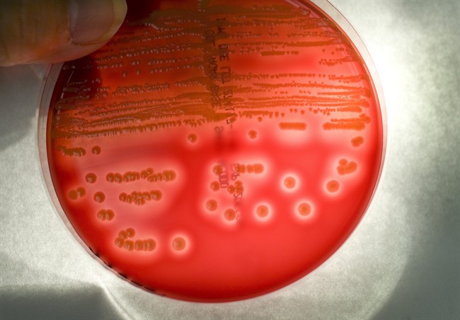 The medical community is trying to battle antibiotic-resistant superbugs.