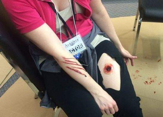 An actor shows off fake wounds and a fake bullet hole during an emergency training exercise held at Airdrie City Hall on Friday, April 29, 2016. 