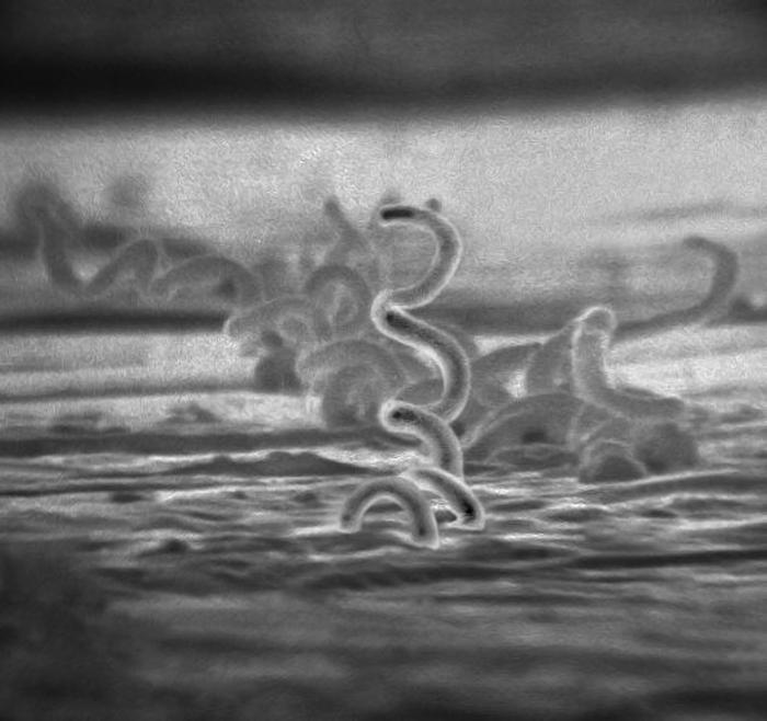 In 2015 Manitoba Health recorded 200 cases of syphilis.  A ten-fold increase. 